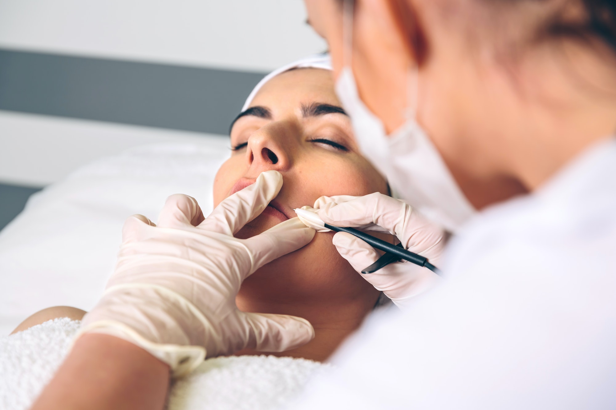 Woman getting rf lifting in her face in clinic